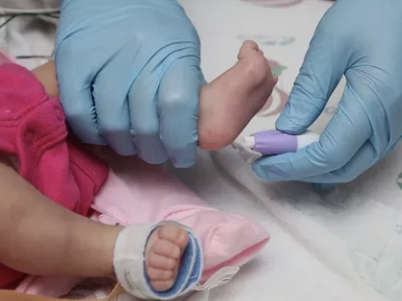 Understanding PKU Treatment: What You Need to Know About Managing Phenylketonuria